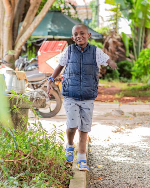 Boy with prosthetic leg