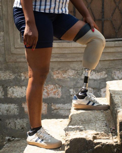 Man with prosthetic leg on steps