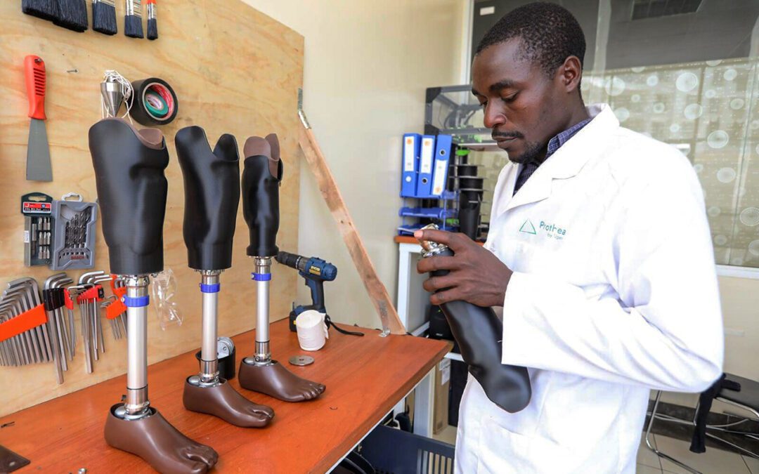 How Innovation is Restoring Hope and Dignity for Amputees